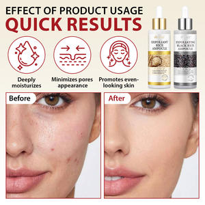 IKZEE 100 มล. เซรั่มบำรุงผิวหน้าสูตรเกาหลี ช่วยผลัดเซลล์ผิว เผยผิวกระจ่างใส ชุ่มชื้น บำรุงผิวด้วยสารสกัดจากข้าวขาวและข้าวดำ เหมาะสำหรับทุกสภาพผิว - Product Image 2