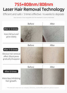 Ev için diyot lazer kalıcı ağrısız epilasyon makinesi Mini 3 dalga boyu 808nm nm 808nm 1064nm taşınabilir 2000W 11mm * 11mm - Product Image 4