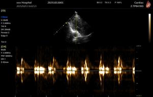 Échographe vétérinaire portable pour clinique hospitalière, fabrication <span class=keywords><strong>d</strong></span>'échographes, échocardiographe 3D couleur Doppler - Product Image 4