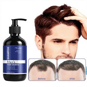 Shampooing Bio Unisexe Nourrissant et Apaisant pour le Cuir Chevelu, Fortifiant et Favorisant la Croissance des Cheveux, Idéal pour les Cuirs Chevelus Sensibles (Marque Blanche) - Product Image 1