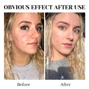 Lavado de cara de Arcilla De Caolín de etiqueta privada para equilibrar y matificar la piel grasa con fórmula a base de aceite reafirmante 2% PHA - Product Image 5