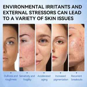 Masques visage coréens LANBENA VITAMIN C, soins de la peau pour femmes - Product Image 6