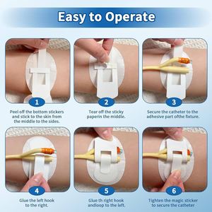 Vente directe d'usine de bande adhésive de fixation pour tubes de drainage médical, bande adhésive de fixation pour cathéter urinaire, et bande adhésive pour dialyse péritonéale des voies biliaires. - Product Image 4