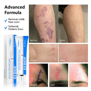 Etiqueta privada, venta al por mayor, producto para el cuidado de la piel, reparación de ojeras, espinillas, crema antiacné para eliminar cicatrices, Gel reafirmante - Product Image 5