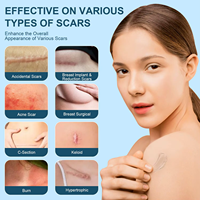 Gel Cicatrisant Avancé en Silicone OEM – Réduit l'Apparence des Vieilles et Nouvelles Cicatrices, Vergetures, Chéloïdes Chirurgicaux, Acné – Crème de Soin Corporel
