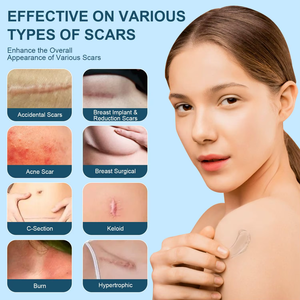 <span class=keywords><strong>Gel</strong></span> Cicatrisant Avancé en <span class=keywords><strong>Silicone</strong></span> OEM – Réduit l'Apparence des Vieilles et Nouvelles Cicatrices, Vergetures, Chéloïdes Chirurgicaux, Acné – Crème de Soin Corporel - Product Image 4