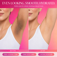 Crème éclaircissante hydratante pour les parties intimes, les aisselles et les zones sensibles, anti-taches brunes, pour femmes, marque privée 4K PLUS Rose