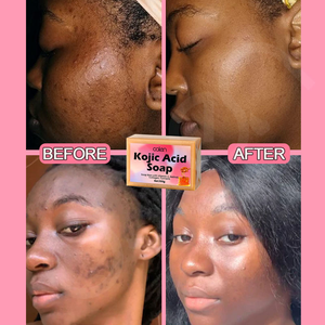 <span class=keywords><strong>Savon</strong></span> à l'acide kojique Luxfume 150g <span class=keywords><strong>Savon</strong></span> artisanal blanchissant exfoliant Lisse la rugosité Éclaircit le teint - Product Image 4