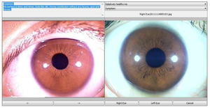 Máquina Analisadora De Saúde Câmeras Digitais Chinesas Máquina Analisadora De Saúde Analisador De Pele - Product Image 5