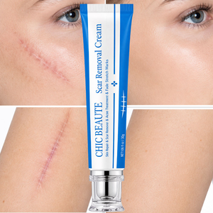 <span class=keywords><strong>Crema</strong></span> Gel Riparatrice Rapida <span class=keywords><strong>per</strong></span> Cicatrici da Acne, Contusioni, Rassodante <span class=keywords><strong>per</strong></span> Pancia e Smagliature, <span class=keywords><strong>per</strong></span> <span class=keywords><strong>Viso</strong></span> e Corpo - Product Image 1