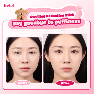 Appareil de cryothérapie pour soins de la peau en gros <span class=keywords><strong>Breteil</strong></span> – Bâtonnet de massage facial rafraîchissant, liftant et anti-rides pour thérapie par le froid - Product Image 3
