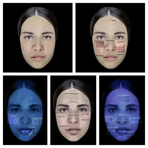 人気のある国が多言語BVスキンアナライザーマシンをサポートし、顔のしわの色素を検出します