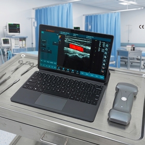 <span class=keywords><strong>Sonde</strong></span> d'échographie Doppler couleur sans fil 3 en 1, 192 éléments, haute résolution - Product Image 1