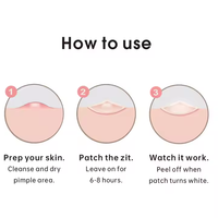 Patch anti-acné à l'huile essentielle en film hydrocolloïde PU à motif de dessin animé, hypoallergénique, adhésif, emballage individuel portable, pour usage facial général