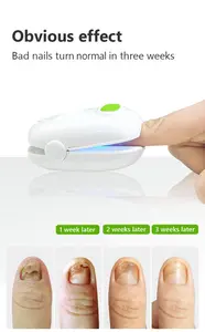 Écran LCD laser pour ongles, dispositif de thérapie fongique, dispositif laser domestique