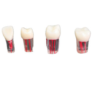 Dents de canal radiculaire dentaire modèle de dents de pratique de formation Endo - Product Image 1
