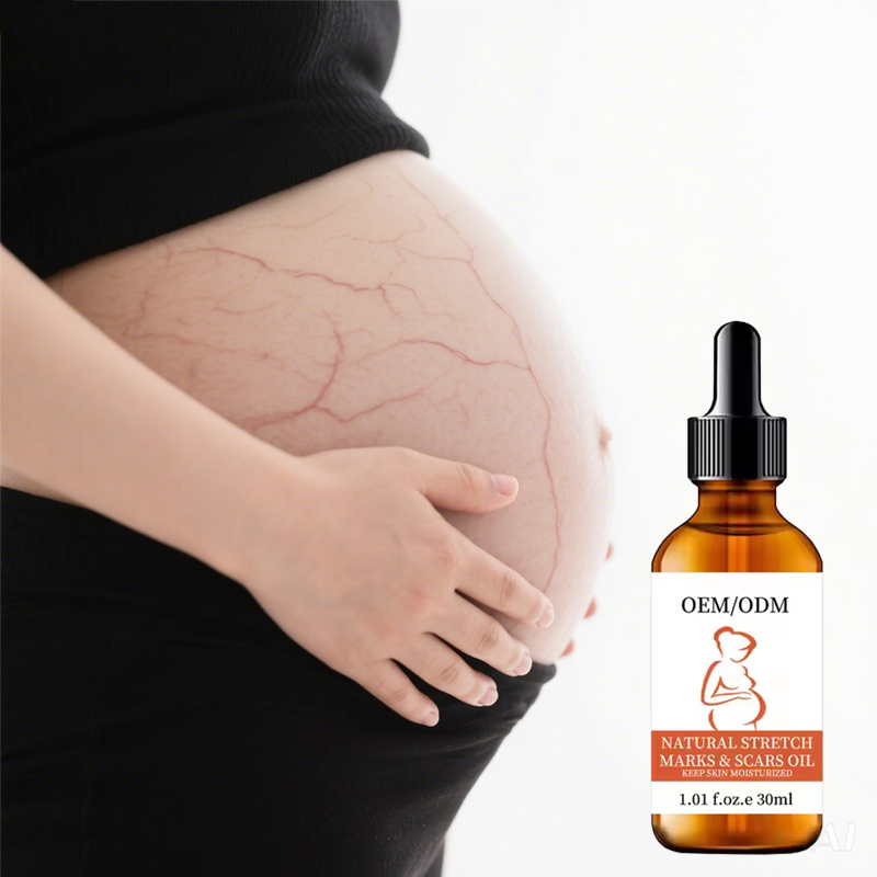 Natural Organic Stretch Marks Removal Oil for Pregnancy Scars Anti Itch Massage Oil Maternity Skin Care Essential Oil