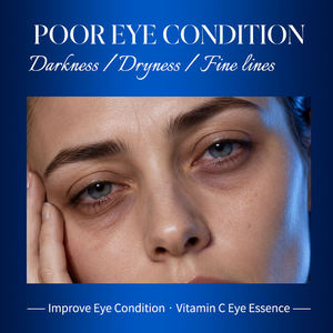 GREENLEM Essence liquide pour les yeux à la vitamine C - Éclaircissant et hydratant pour le soin des yeux - Product Image 3