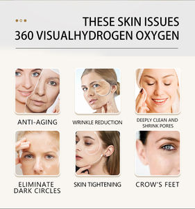 Juego Completo <span class=keywords><strong>de</strong></span> Seis Instrumentos <span class=keywords><strong>de</strong></span> Hidrodermoabrasión con Oxígeno para el Cuidado <span class=keywords><strong>de</strong></span> la Piel, Antienvejecimiento, Limpieza Profunda y Reducción <span class=keywords><strong>de</strong></span> Poros - Product Image 5