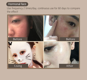 Bùn tấm mặt nạ Vá tốt nhất sâu lỗ chân lông làm sạch điều trị Mặt nạ đất sét cho mặt nạ trên khuôn mặt - Product Image 3