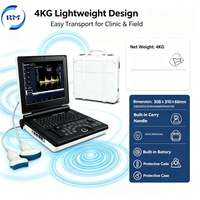 Appareil d'échographie Doppler couleur portable B/CFM/PW avec écran LED de 12 pouces, appareil d'échographie à double usage humain et vétérinaire