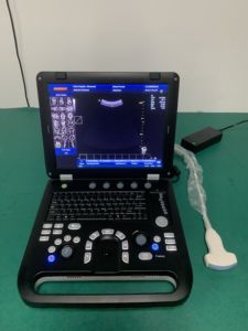 CE Meilleur <span class=keywords><strong>Prix</strong></span> Échographe Portable 3D Couleur Doppler pour Clinique et Hôpital SUN-906A - Product Image 3
