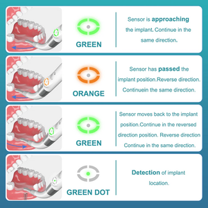 Sensor de tratamiento de conductos radiculares dentales, localizador de implantes dentales inteligente, posicionador de escaneo cruzado preciso, destornillador portátil de precisión - Product Image 4