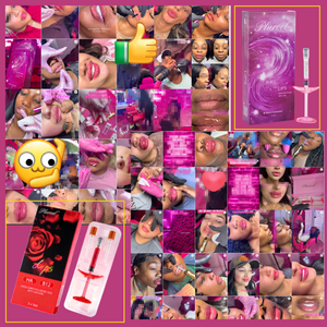 Inyección Labial Roja <span class=keywords><strong>de</strong></span> Grado Médico <span class=keywords><strong>de</strong></span> 1 ml con Vitamina B12 Añadida para una <span class=keywords><strong>Aumento</strong></span> <span class=keywords><strong>de</strong></span> <span class=keywords><strong>Labios</strong></span> Profesional Seguro y Efectivo - Product Image 6