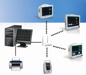 Monitor paziente veterinario Multiparamet palmare frequenza cardiaca SpO2 portatile <span class=keywords><strong>ECG</strong></span> portatile - Product Image 2