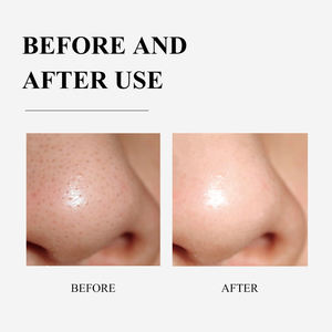 BREYLEE-mascarilla con tiras para la nariz, máscara para eliminar puntos negros, con absorción de árbol de té natural, novedad - Product Image 6