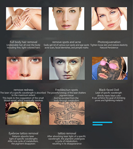 Appareil professionnel deux-en-un pour l'épilation 810 nm et l'élimination des taches noires et des tatouages - Product Image 5
