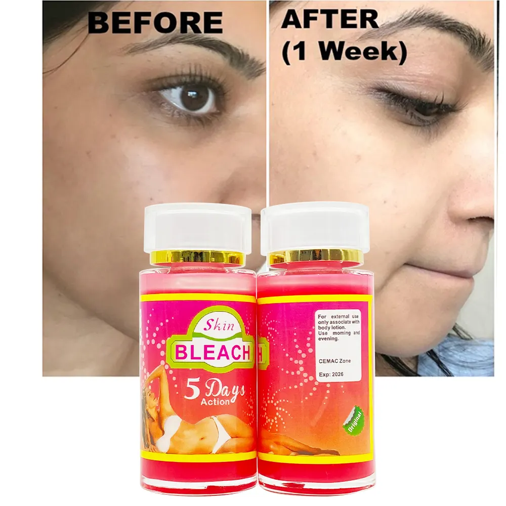 Super Eclaircissant 5Days Fast Action Booster Serum for Anti-Aging Eliminate Skin Pigmentation Remove Pimples Lightening Serum