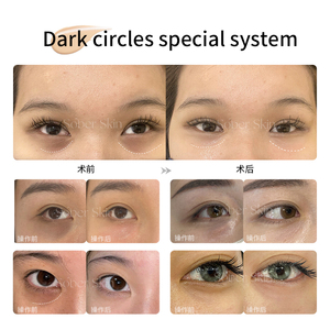 مجموعة وشم صبغة الجلد لعلامات التمدد مجموعة أصباغ التمويه أداة Microblading - Product Image 6