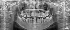 Máquina de Tomografía Computarizada <span class=keywords><strong>Dental</strong></span> de Segunda Mano, Soporte para Video/Inspección en Sitio, Opción Rentable, Imágenes de Ultra Alta Definición - Product Image 5