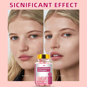 <span class=keywords><strong>Oem</strong></span> 5000Mg Glutathion Collageen <span class=keywords><strong>Capsule</strong></span> Capsules Private Label Huid <span class=keywords><strong>Whitening</strong></span> Glutathion Softgel Collageen Supplementen - Product Image 5