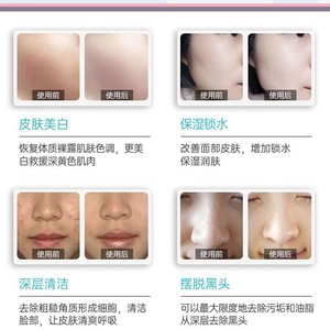 Nano Oxygen Infusion Device High Pressure Spray For Skin Rejuvenation Cleansing Whitening Commercial Use - Product Image 1