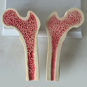 Gran Venta de patología de la osteoporosis y modelo de enseñanza de densidad ósea saludable para estudiar - Product Image 4