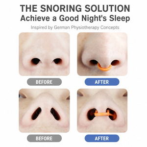 <span class=keywords><strong>Dilatadores</strong></span> <span class=keywords><strong>nasales</strong></span> para respirar Logotipo personalizado Dilatador nasal Dispositivo antirronquidos Clip nasal de silicona para la nariz - Product Image 4