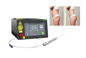 Factory <strong>Price</strong> 1470nm 980nm Diode Laser Equipment Laser Face Lifting <strong>Lipolysis</strong> Laser Liposuction <strong>Machine</strong> - Product Image 4