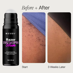 Razor Bump Stopper Solution <strong>for</strong> Ingrown Hair <strong>Aftershave</strong> Skin Care <strong>for</strong> Men and <strong>Women</strong> - Product Image 4