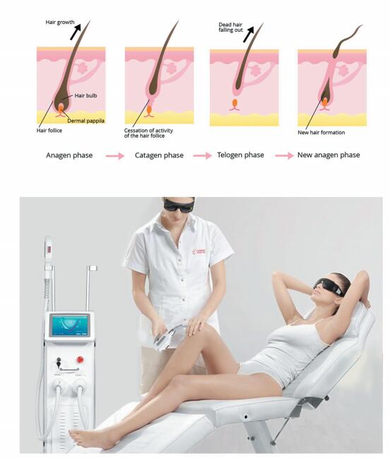 Super Nano Light OPT SHR IPL for hair removal/skin rejuvenation/Vascular Therapy & Breast lift