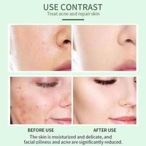 Ampoule Sérum Boostant Centella <span class=keywords><strong>Matrixyl</strong></span> – Réparateur Apaisant pour Peaux Sensibles – Essence Visage Anti-Âge Hydratante - Product Image 5