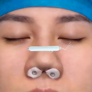 Esponja <span class=keywords><strong>Nasal</strong></span> Desechable de Emergencia, Esponja <span class=keywords><strong>Merocel</strong></span> de PVA, Apósito <span class=keywords><strong>Nasal</strong></span> Quirúrgico, Tapón <span class=keywords><strong>Nasal</strong></span> Blanco, Esponja Personalizable de Marca - Product Image 1