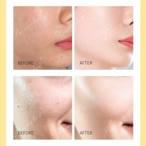 Ensemble de soins naturels pour les lèvres, vente en gros de produits de beauté biologiques, gommage pour les lèvres roses, masque de nuit pour les lèvres au collagène, 5 pièces - Product Image 6
