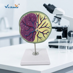 แบบจำลองทางกายวิภาคของรกและภาวะมดลูกอักเสบ ได้รับการรับรองมาตรฐาน CE ISO สำหรับการสอนทางสูติศาสตร์ในสถาบันการแพทย์ - Product Image 6