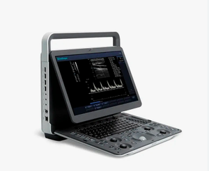 Escáner de Ultrasonido Veterinario Portátil en Blanco y Negro <span class=keywords><strong>SonoScape</strong></span> <span class=keywords><strong>E1</strong></span> <span class=keywords><strong>Vet</strong></span> para Diagnóstico de Mascotas y Ganado - Product Image 2