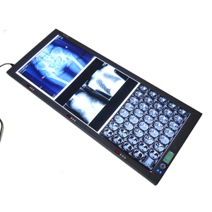 Medical X Ray <span class=keywords><strong>Film</strong></span> Viewer Portable LED <span class=keywords><strong>x-ray</strong></span> <span class=keywords><strong>Film</strong></span> View illuminatore radiografia negatoscopio - Product Image 2