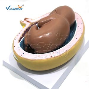 ชุดแบบจำลองการตั้งครรภ์ 9 แบบ สำหรับการศึกษาทางวิทยาศาสตร์การแพทย์  โครงสร้างพัฒนาการของทารกในครรภ์ในช่วงต่างๆ - Product Image 6