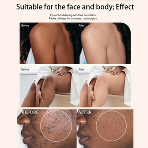 El Nuevo Jabón Marroquí Nila, Jabón Blanqueador <span class=keywords><strong>para</strong></span> Aclarar Manchas y Eliminar Imperfecciones en Cuerpo y Rostro - Product Image 5