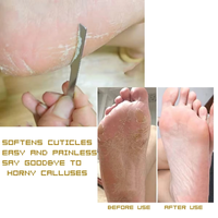 Ensemble de 3 couteaux de pédicure en acier inoxydable avec lime à pieds, grattoir et râpe à pieds - Double face, manche long pour le soin des ongles incarnés
